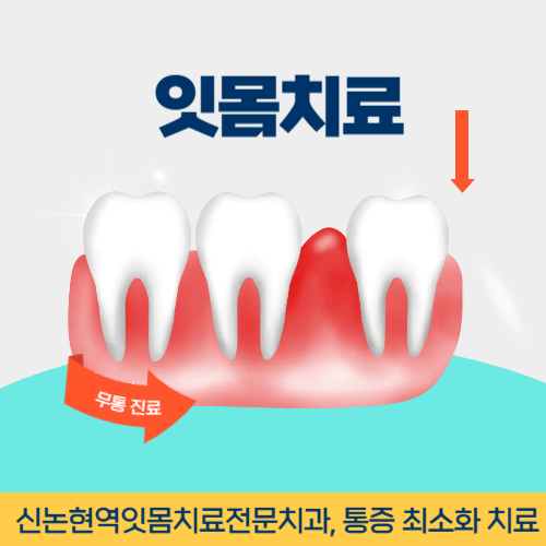 세종치과 세종특별자치시 치과 잇몸치료